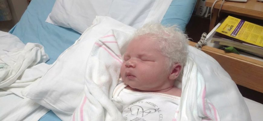 Ein Junge, der mit weißen Haaren geboren wurde: Die Geschichte von Bence aus Ungarn